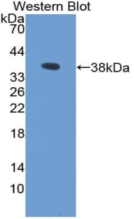 LDHB / Lactate Dehydrogenase B Antibody (aa1-334)