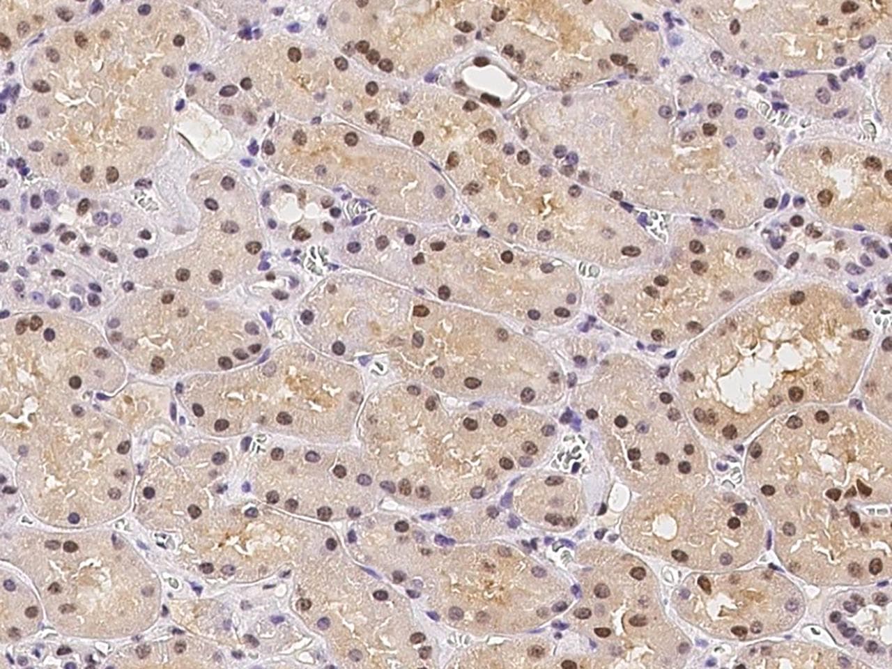 ATXN7L2 Antibody