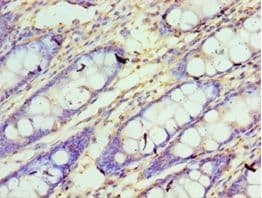CXXC1 / CGBP Antibody (aa1-210)