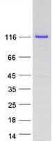 Human EIF3B Protein (Recombinant Myc-DDK (Flag))