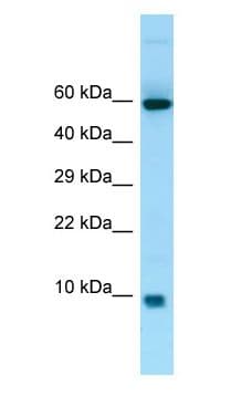 Polyclonal Rabbit anti-Human S100A7A / S100A15 Antibody (C-Terminus, WB)