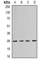Polyclonal Rabbit anti-Human RAB11A Antibody (IF, WB)