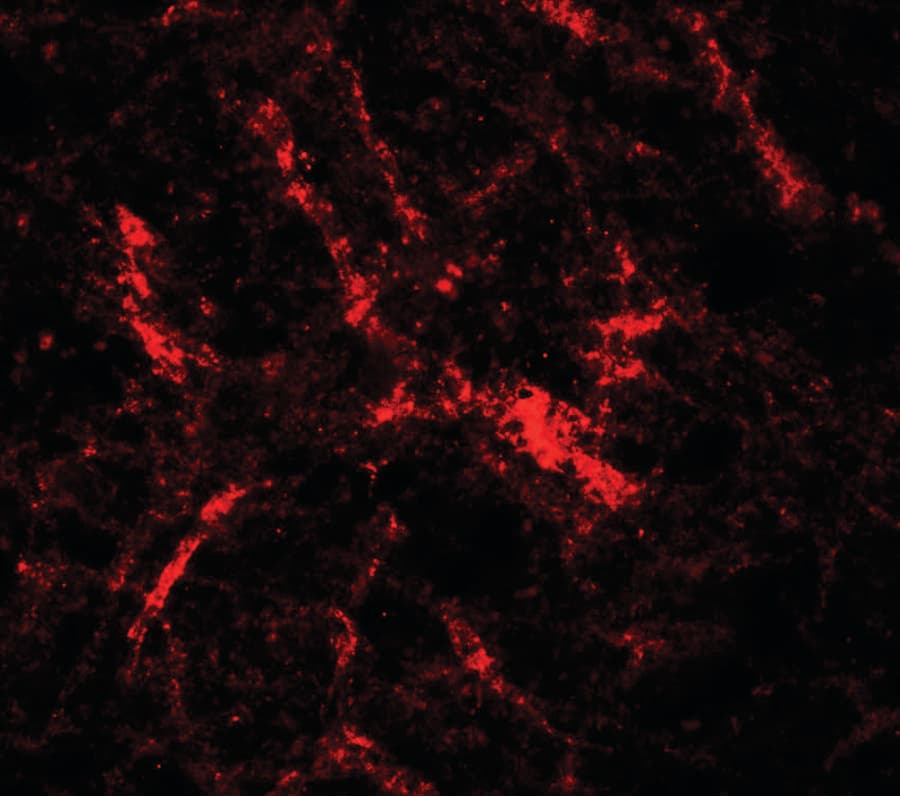 RUSC2 Antibody