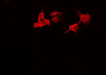 Polyclonal Rabbit anti-Human PPP1R3A / GM Antibody (IF, WB)