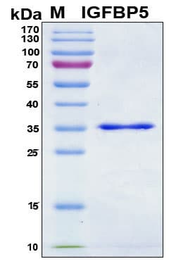 Human IGFBP5 Protein (Recombinant 6His, N-terminus)