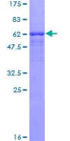 Human CRHBP Protein (Recombinant GST)