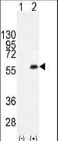 PKMYT1 Antibody (aa452-482)
