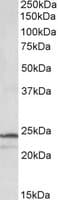 IHC-plus™ Polyclonal Goat anti-Human PSMB3 Antibody (aa72-81, IHC, WB)