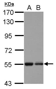 KBTBD4 Antibody