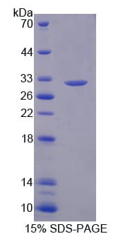 Mouse DPYD / DPD Protein (Recombinant His-T7)