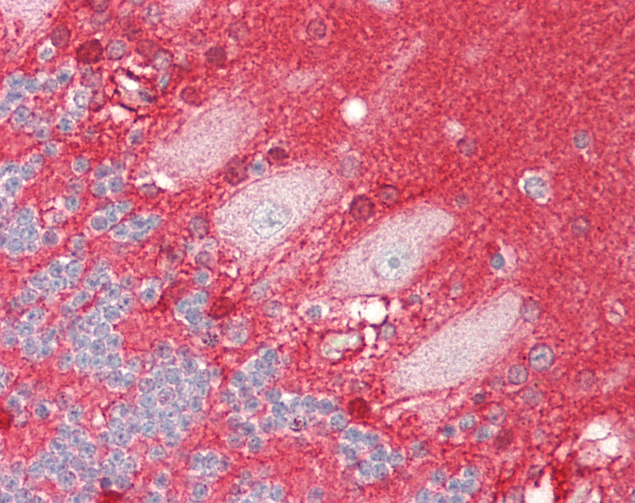 ADD3 Antibody (aa261-310)