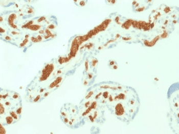 SPTA1 / Alpha Spectrin Antibody (clone SPTA1/1832)