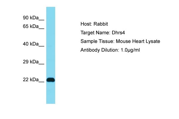DHRS4 / PSCD Antibody (aa51-100)