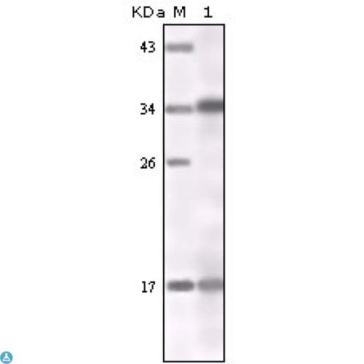 IFN Gamma / Interferon Gamma Antibody