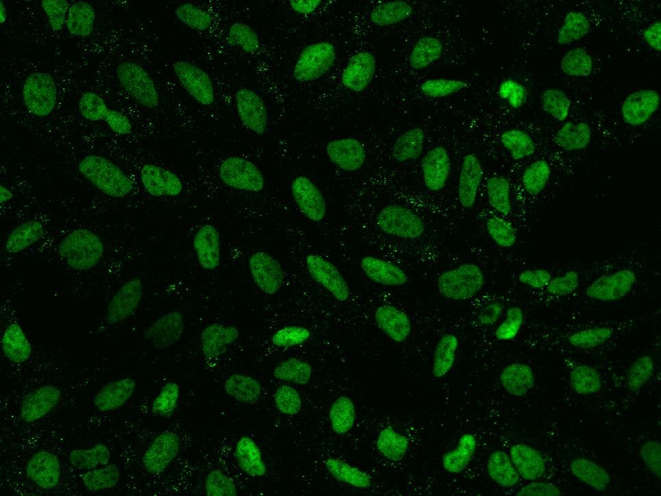 Polyclonal Rabbit anti-Human MSH6 Antibody (IF)