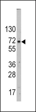 SLC2A2 / GLUT2 Antibody (aa31-60)