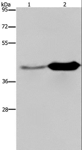 GLUL / Glutamine Synthetase Antibody