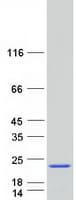 Human STMN1 / Stathmin / LAG Protein (Recombinant Myc-DDK (Flag))
