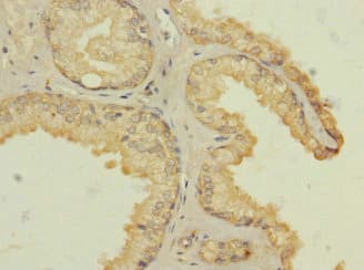 Polyclonal Rabbit anti-Human HTR3B / 5-HT3B Receptor Antibody (IHC, WB)