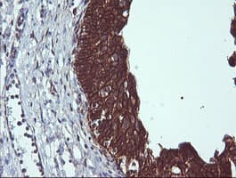 BCL2L1 / BCL-XL Antibody (clone OTI2D1)