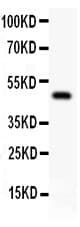 TFAP2A / AP-2 Antibody (aa1-166)