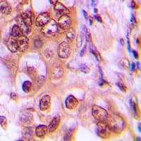 Polyclonal Rabbit anti-Human CDKN1B / p27 Kip1 Antibody (phospho-Thr187, IHC, IF, WB)