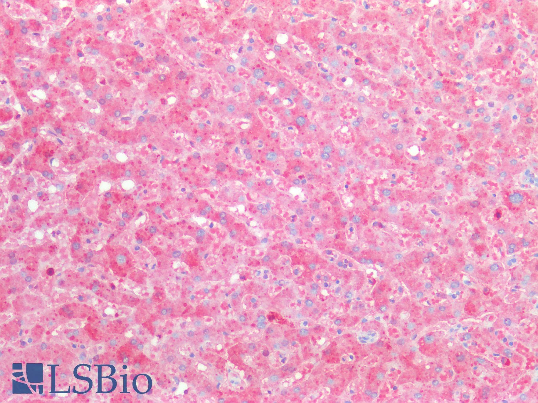 IHC-plus™ Polyclonal Rabbit anti-Human ORM2 / Orosomucoid 2 Antibody (IHC, WB)