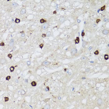 MIP / AQP0 / Aquaporin 0 Antibody