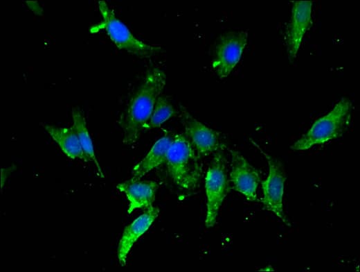 TBP / GTF2D Antibody