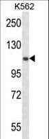 UBA1 / UBE1 Antibody (aa1-30)