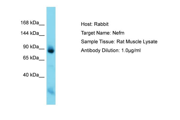 NEFM / NF-M Antibody (C-Terminus)