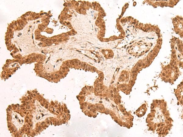 ARMC8 Antibody