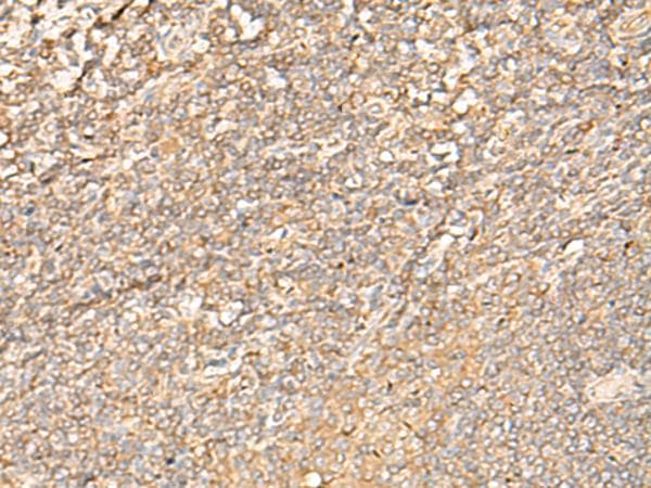 EIF3C / EIF3S8 Antibody