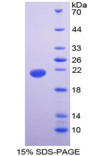 Human CASP3 / Caspase 3 Protein (Recombinant His-T7)