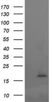 Monoclonal Mouse anti-Human CTAG1B / NY-ESO-1 Antibody (clone OTI3H8, IHC, IF, WB)