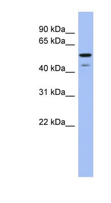PathPlus™ BMP6 Antibody (aa359-408)