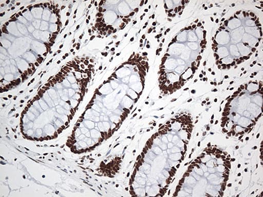 EWSR1 / EWS Antibody (aa256-447, clone OTI3F6, Carrier-free)