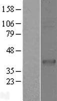 CD1C Protein (Over-Expression Lysate Myc-DDK (Flag))