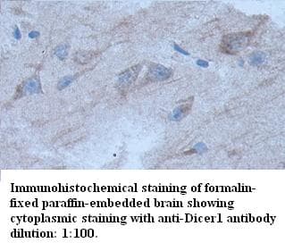 DICER1 / Dicer Antibody
