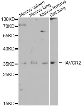 HAVCR2 / TIM-3 Antibody