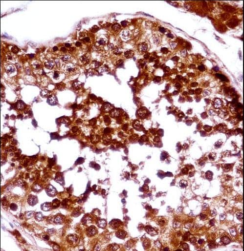 LW-1 / HSFX1 Antibody (aa201-230)