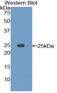 TREM1 Antibody (aa21-230)