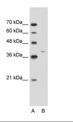 Polyclonal Rabbit anti-Human KRT13 / CK13 / Cytokeratin 13 Antibody (C-Terminus, IHC, WB)