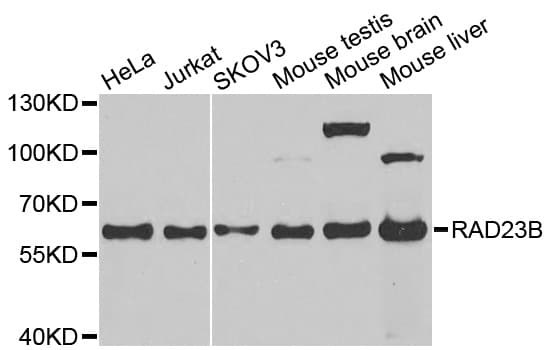 RAD23B / HR23B Antibody