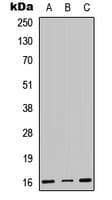 Polyclonal Rabbit anti-Human CENPA / CENP-A Antibody (N-Terminus, IHC, WB)