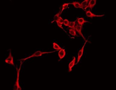 SERPING1 / C1 Inhibitor Antibody