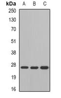 Polyclonal Rabbit anti-Human GSTM4-4 / GSTM4 Antibody (WB)