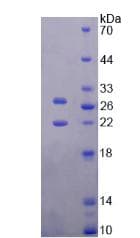 Mouse TIMP3 Protein (Recombinant His, N-Terminal)