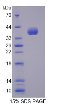 Human NCAN / Neurocan Protein (Recombinant His)