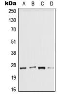 IL37 Antibody (Internal)